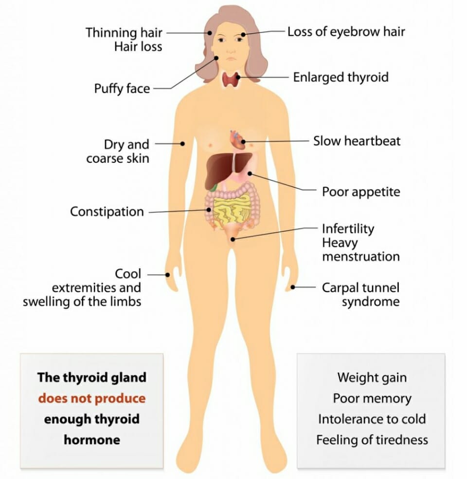 Post-Partum Thyroiditis