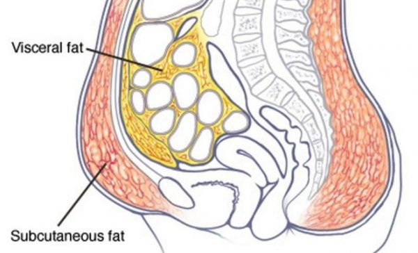 Under Rib Fat The different types of tummy fat and how to lose it for GOOD
