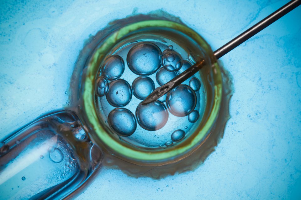 IVF