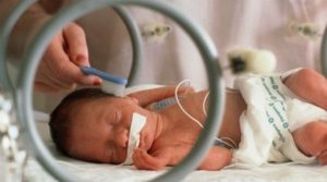 Research finds the survival rate of premature babies has rapidly improved since the ‘80s
