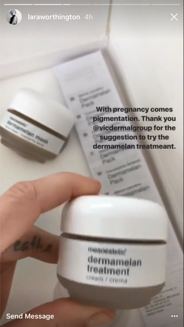 Lara Bingle pregnant