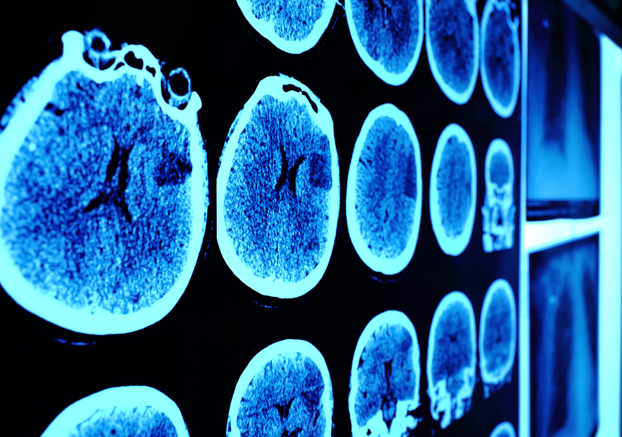 Skull CT scan picture on the wall in perspective