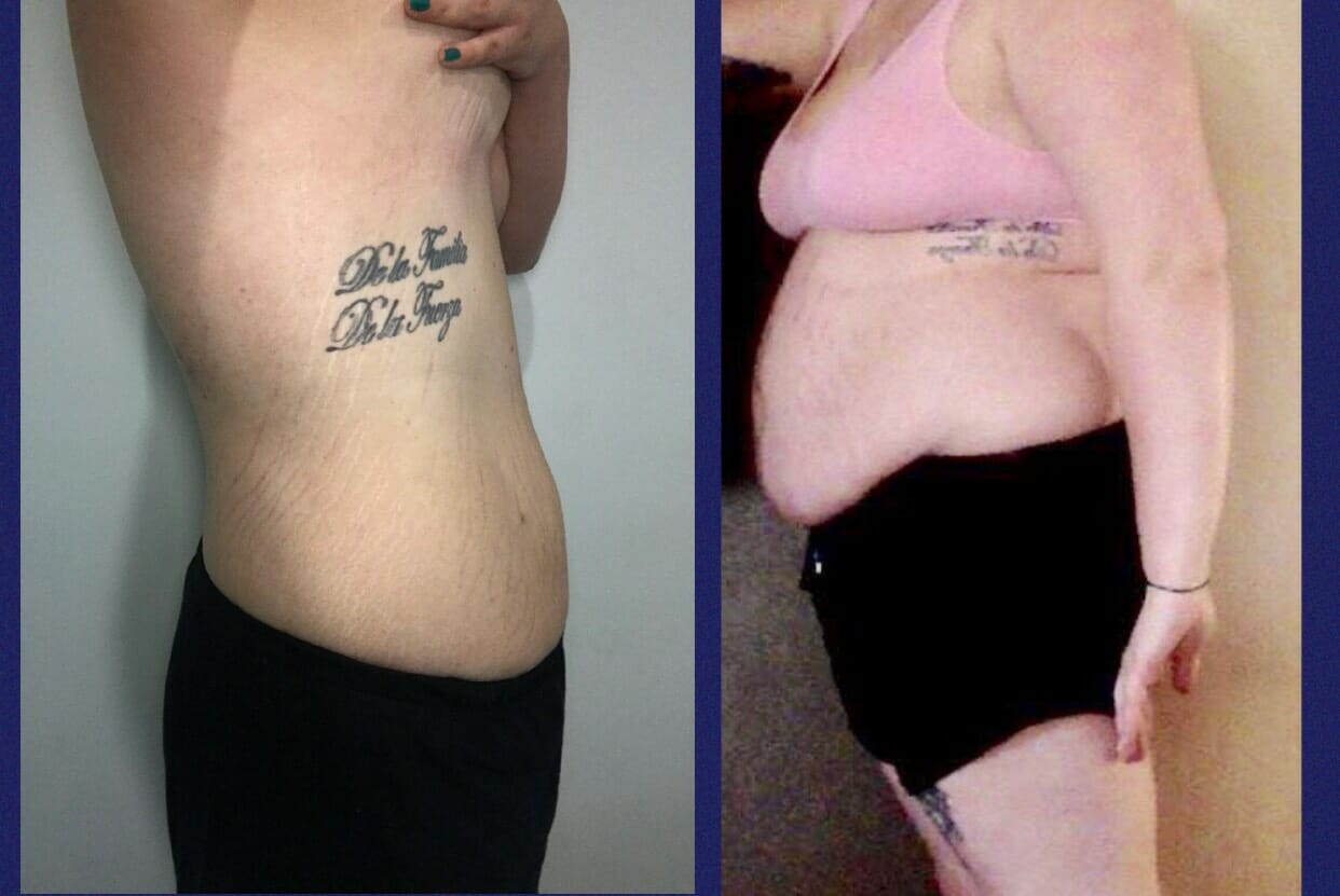 This mum tells "how I lost my belly fat and cm from my body" Melanie before and after